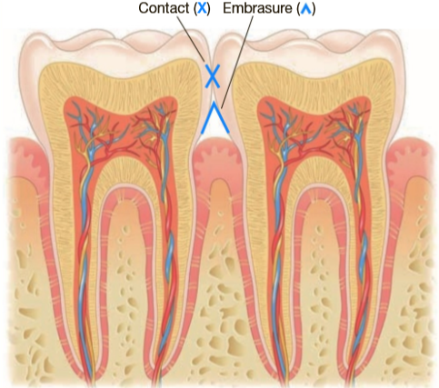 <p>Triangular spaces between teeth near the gingiva</p>