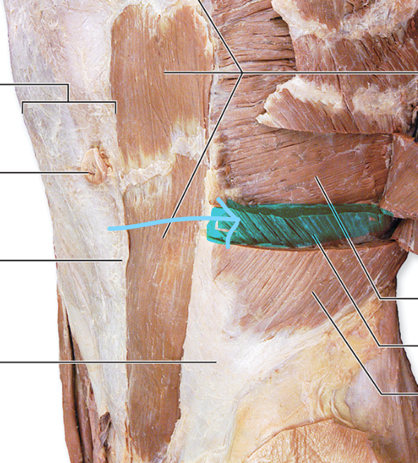 <p>Internal Oblique</p>
