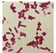 <p>What is the name of this bacterium?</p>