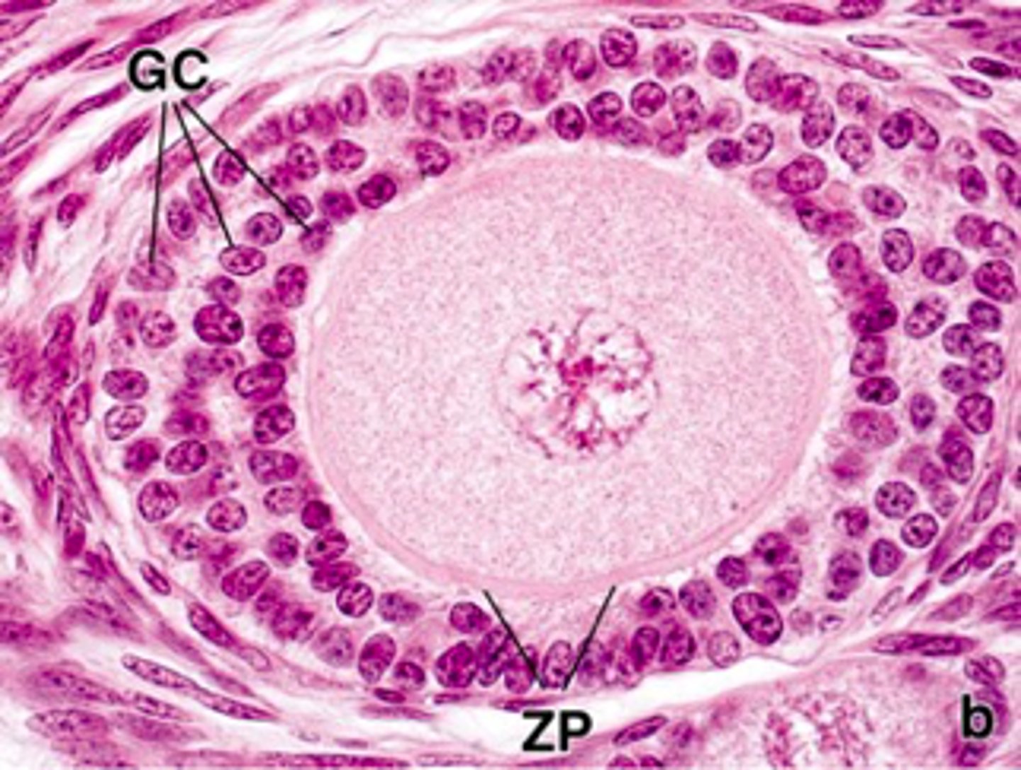 <p>ID the ovarian cell stage:</p>