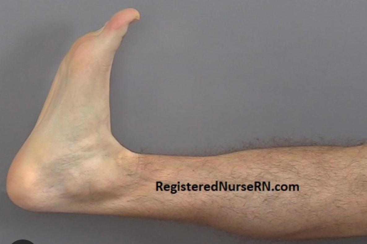 Pulling the toes of the foot towards the shin 