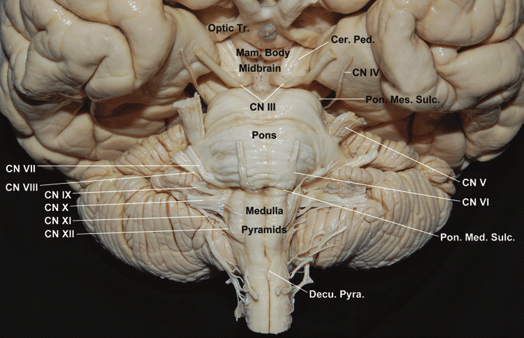 <p><span>anterior part of the midbrain that </span>connects the brainstem to the thalami</p>