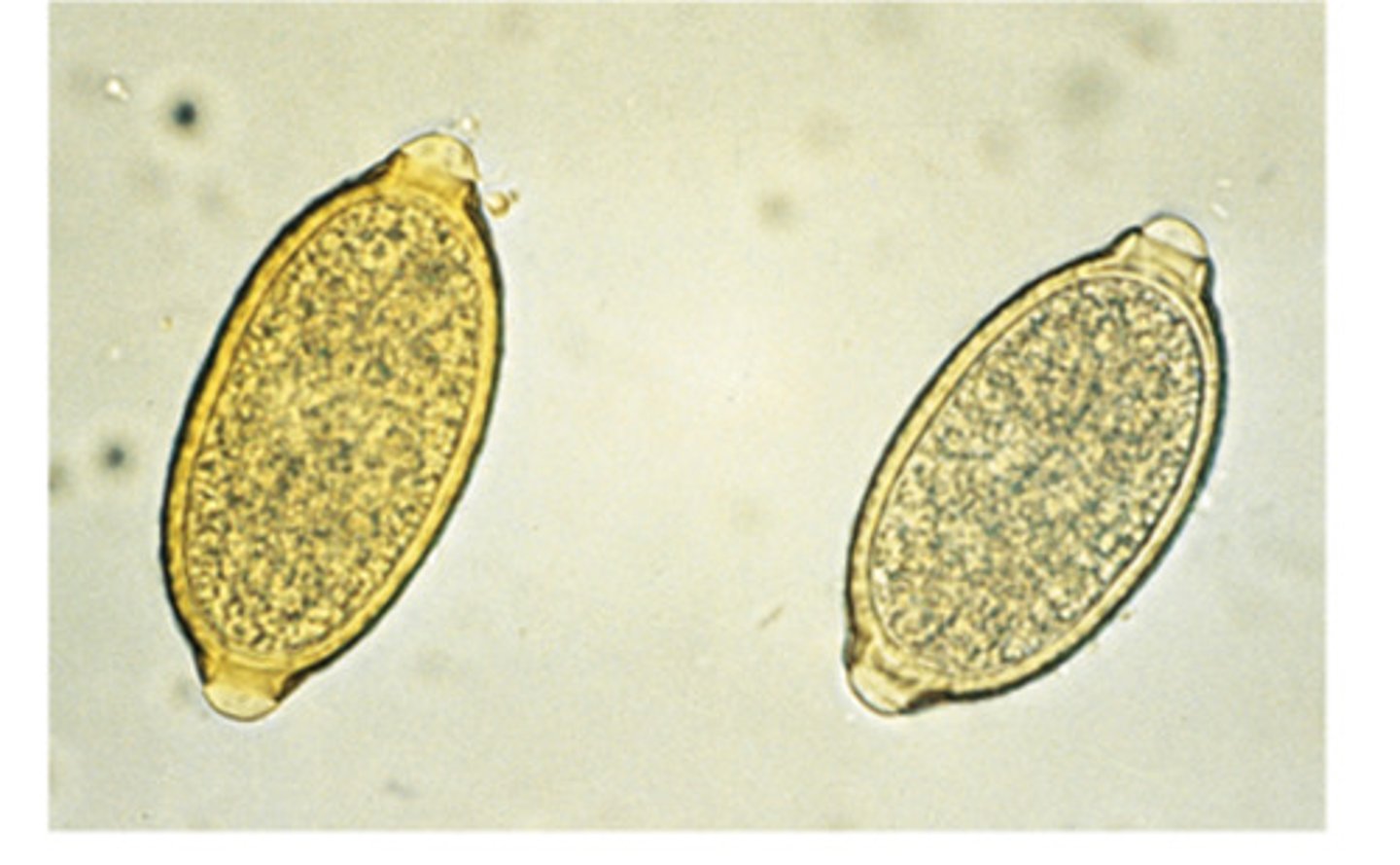 <p>This respiratory nematode that is commonly misidentified as Trichuris vulpis is</p>