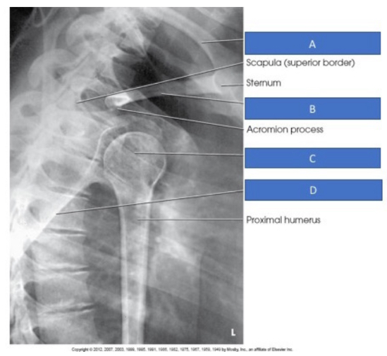 <p>Name Letter B</p>