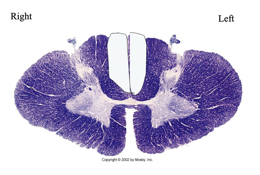 <p>What clinical findings would you expect with each of these lesions?</p>