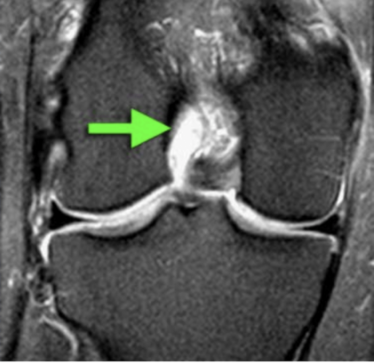 <p>Define the pathology.</p>