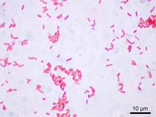 More complex cell walls
Less pepidoglycan
Have an outer lipopolysaccharide layer
After staining: appear red
example slides:
esherichia coli, Spirillum volutans, Proteus vulgaris