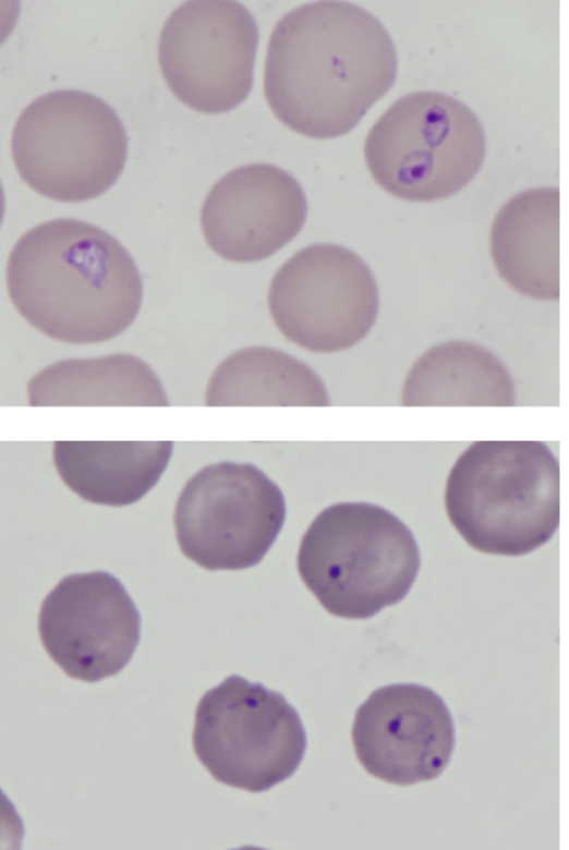 <p>What are the two species of babesiosis dogs are mainly infected by? How can you tell them apart? </p>