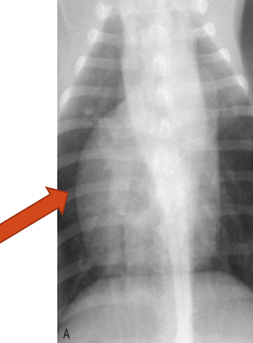 <p>What is the arrowing pointing to? </p>