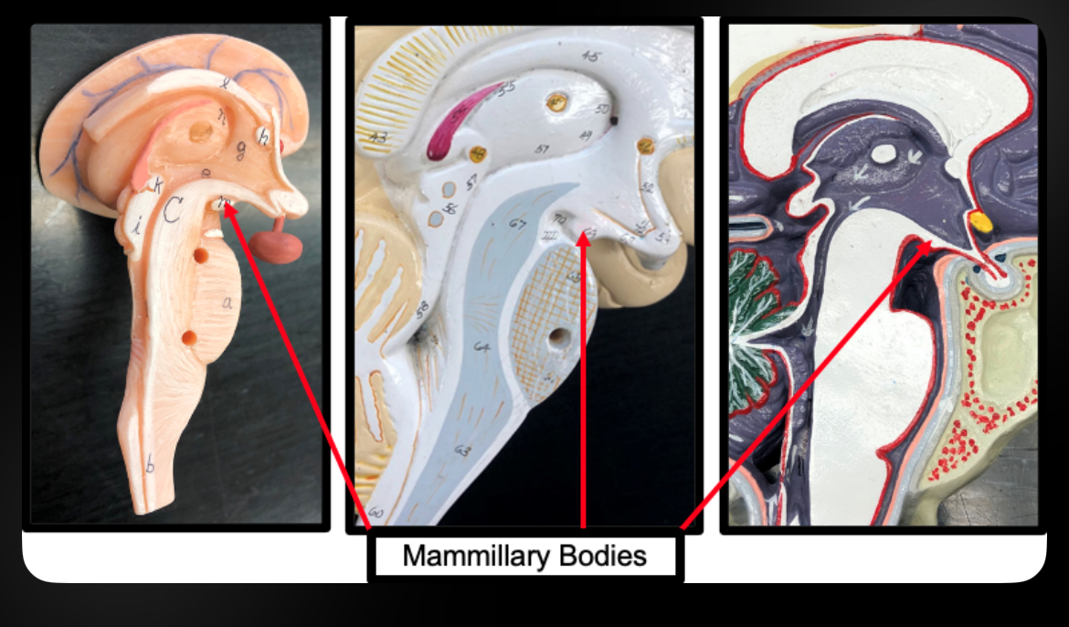 <p>Mammillary Bodies</p>