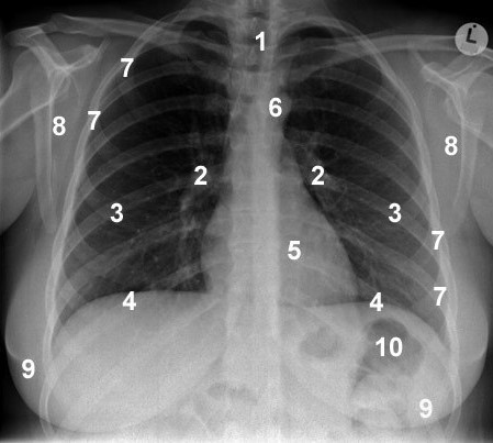 <p>What anatomical structure is number 1?</p>