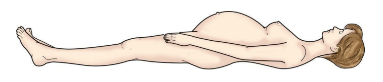 <p>A client has received epidural anesthesia to control pain during a vaginal birth. Place an X over the highest point on the body locating the level of anesthesia expected for a vaginal birth.</p>