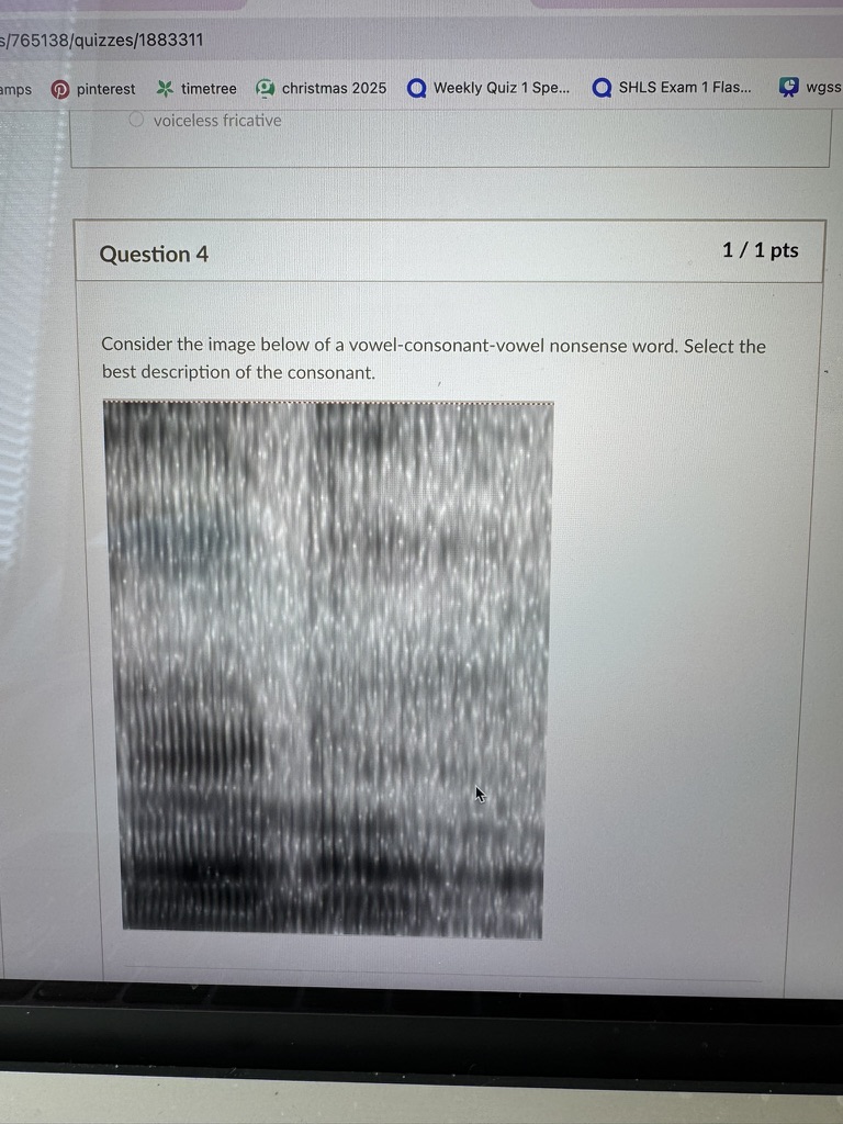 <p>Consider the image below of a vowel-consonant-vowel nonsense word. Select the best description of the consonant.</p>