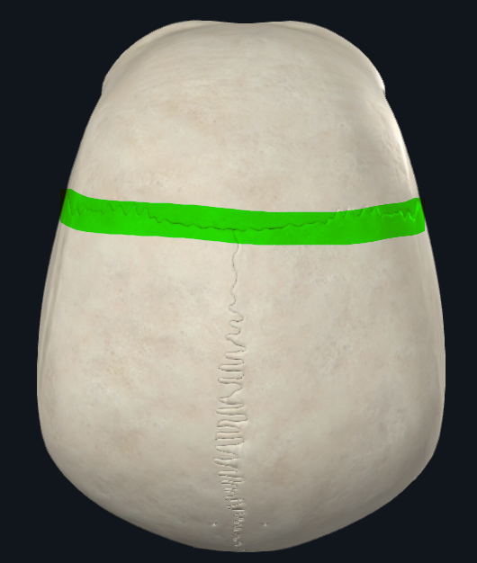 <p>Frontoparietal</p>