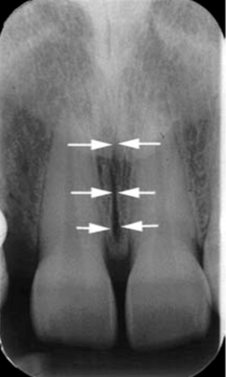 <p>Identify the structure</p>