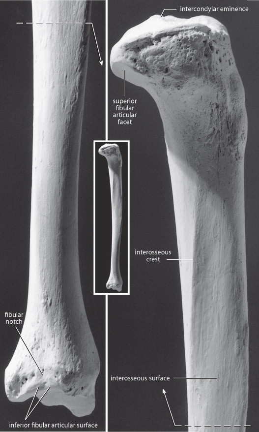 <p>small oval facet on the lateral end of the lateral condyle. on the side of the bone it is from</p>