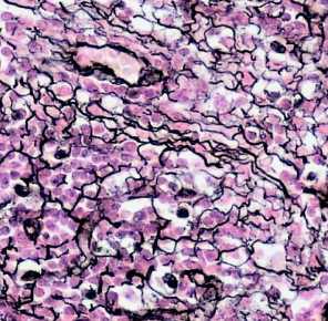 <p>Identify this connective tissue, its location, and its function.</p>