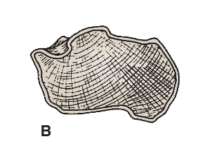 <p>unassigned groups</p><ul><li><p>thin shell of compact bone with interior made of cancellous bone</p></li></ul><p></p>