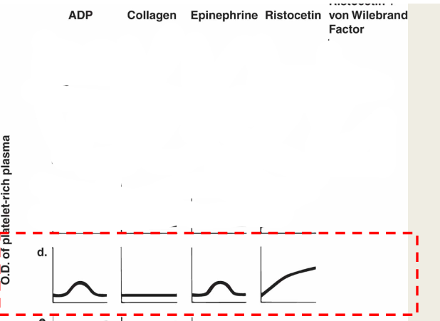 <ul><li><p>ADP: starts then disintegrates</p></li><li><p>Epinephrine: starts then disintegrates</p></li><li><p>Collagen: starts then disintegrates</p></li><li><p>Ristocetin: norm</p></li><li><p>Ristocetein +NL plasma: norm</p></li><li><p>Archidonic acid: if still abnormal then aspirin</p></li></ul><p></p>