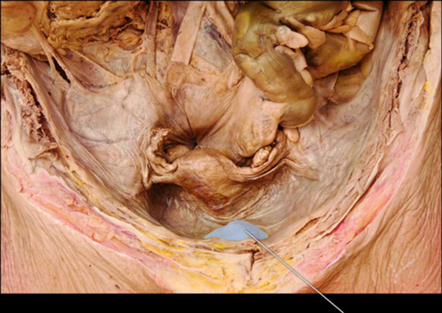 <p>urinary bladder</p>
