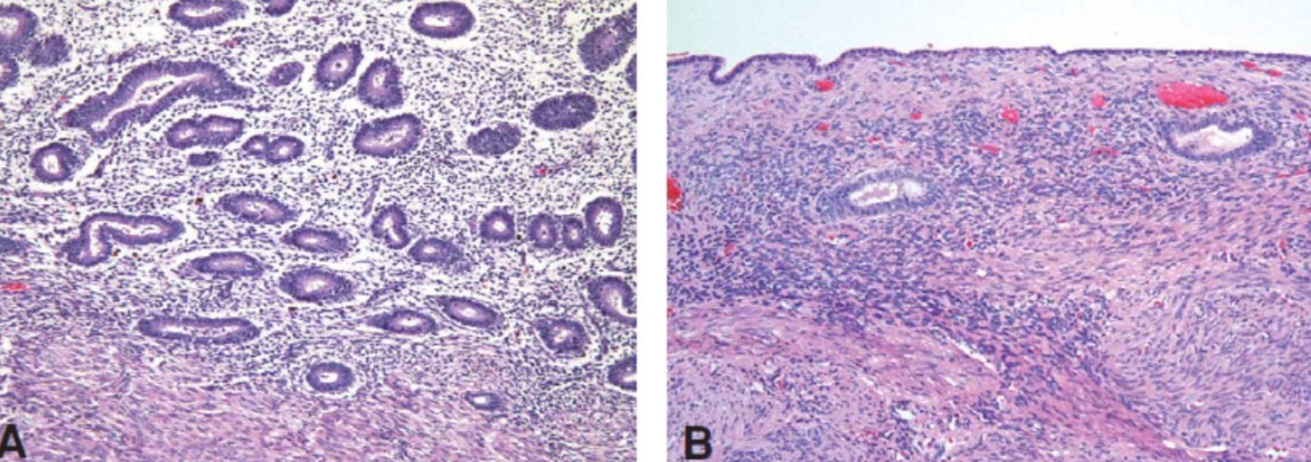 <p>what cell adaptation is depicted</p>