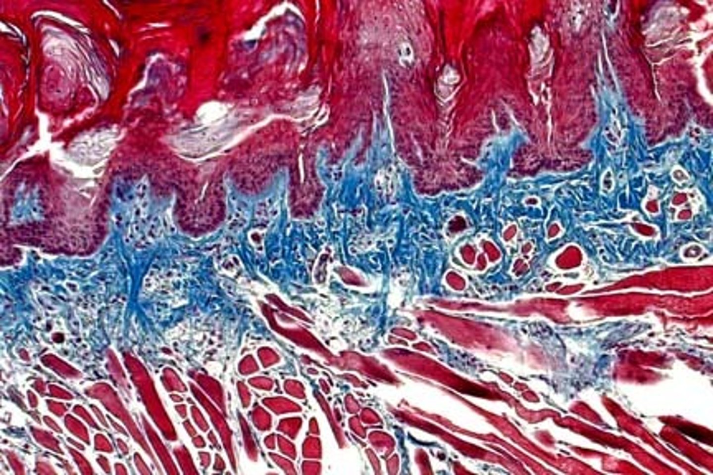 <p>1. Dark blue: nuclei</p><p>2. Red: muscle, keratin, cytoplasm</p><p>3. Light blue: mucinogen, collagen</p>