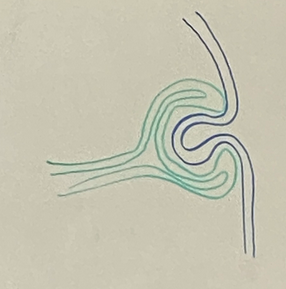 <p>two most ventral parts of surface ectoderm join up together</p>