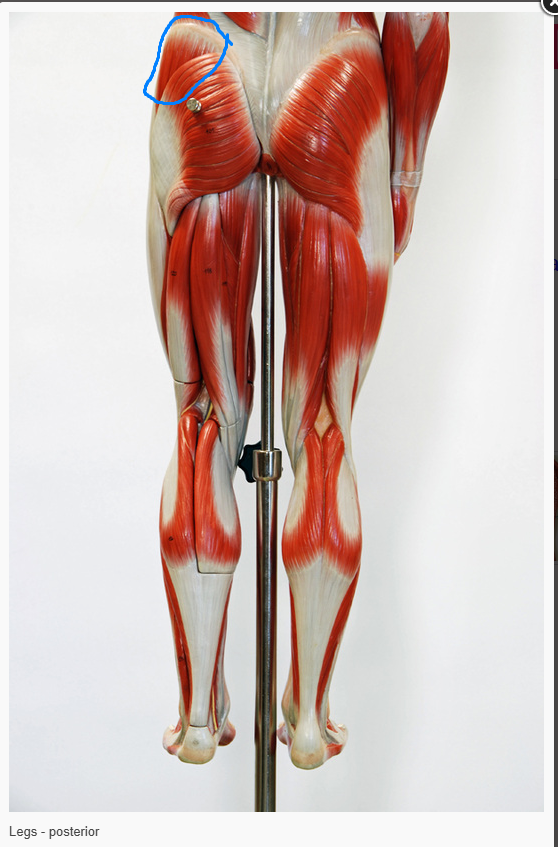 <p>What is the name of the muscle circled&nbsp;</p>