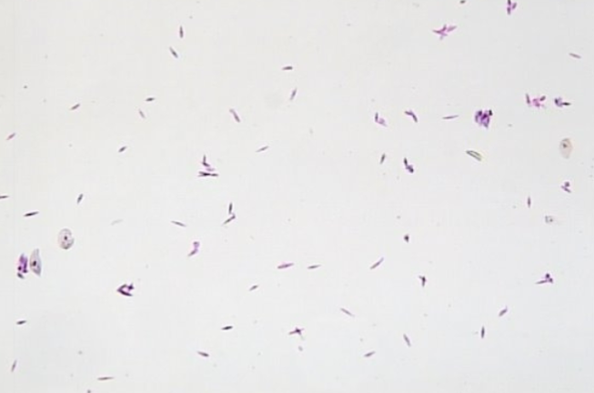 <p>Uses Flagella for movement</p>