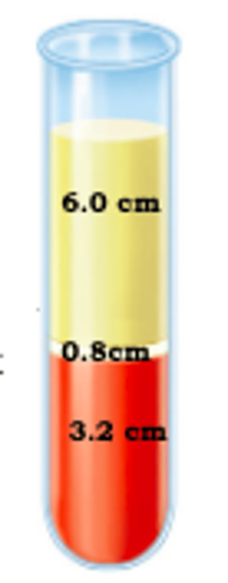 <p>32%</p>