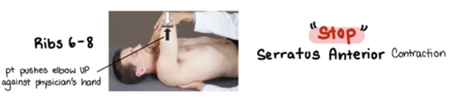 <p>"stop"</p><p>m: serratus anterior</p><p>pt pushes elbow UP against physicians hand</p><p>stand on same side as SD </p><p>index and middle finger hook onto posterior and SUPERIOR aspect of the dysfunctional rib pulling rib inferolaterally at the rib angle</p><p>ribs are stuck DOWN</p>