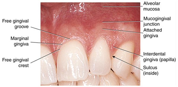 <p><span>Does not bleed when probed and has surface stippling (looks like an orange peel). The stippling is caused by the connective tissue fibers attaching the epithelium to the underlying bone. The interdental papilla (IP) fills in the area between the teeth up to their contact areas and prevents food from becoming lodged or impacted between teeth.</span></p>
