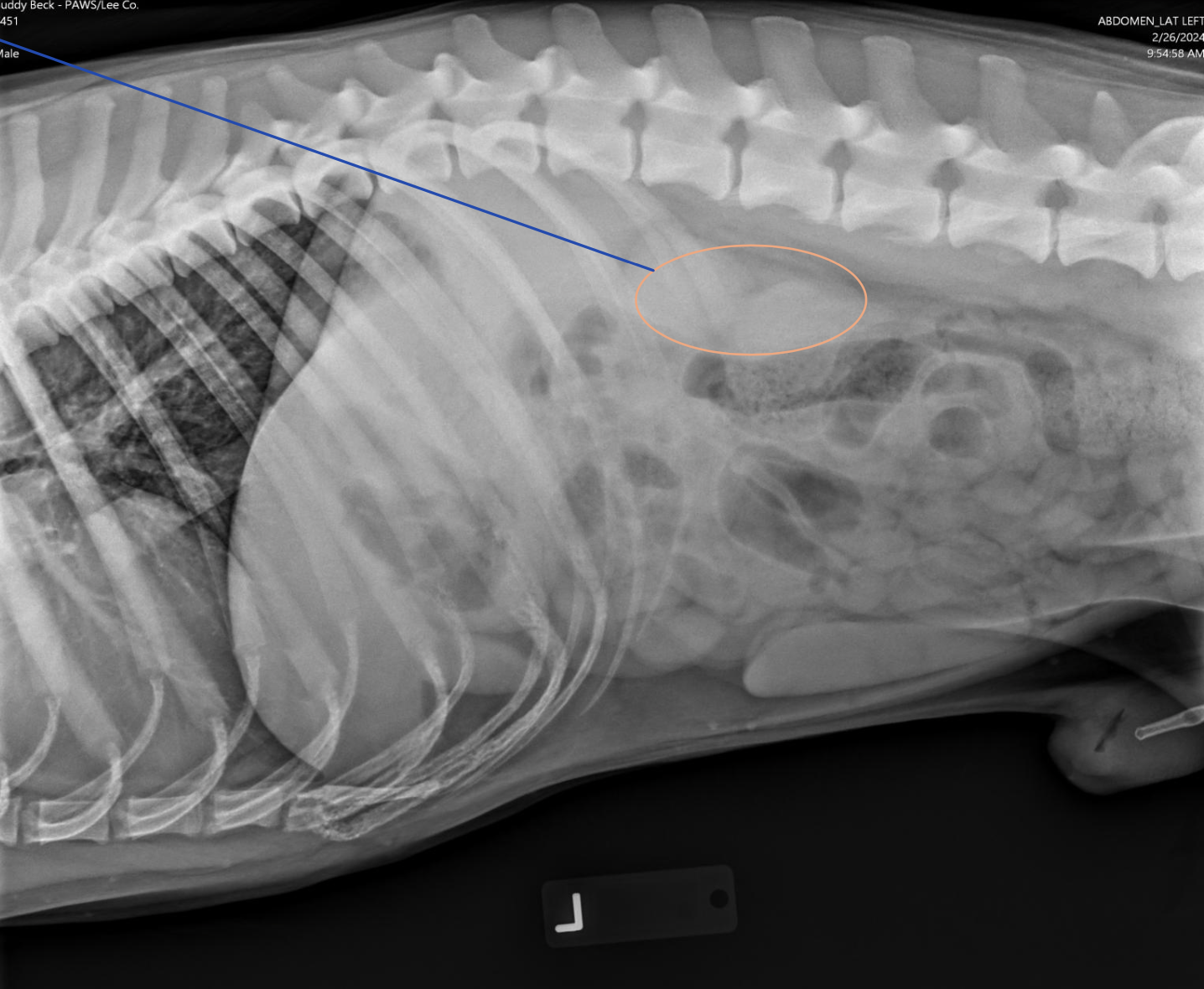 <p>What term defines: “opacity created that does NOT represent a structure that is present within the patient”?</p>