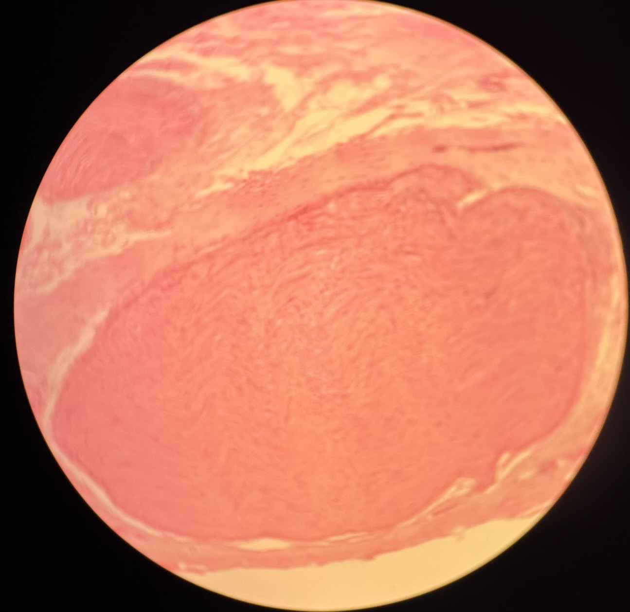 term image
