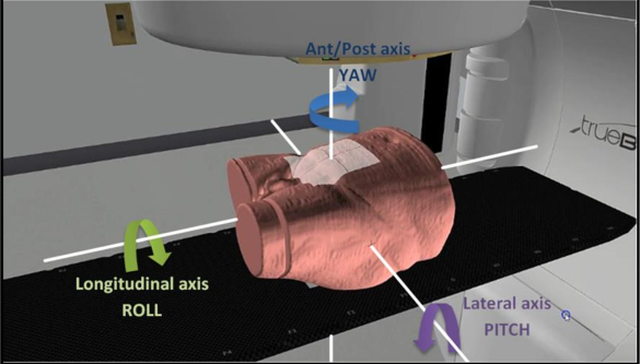 <p>the rotational movement about the lateral axis, causing the patient to tip anteriorly or posteriorly</p>