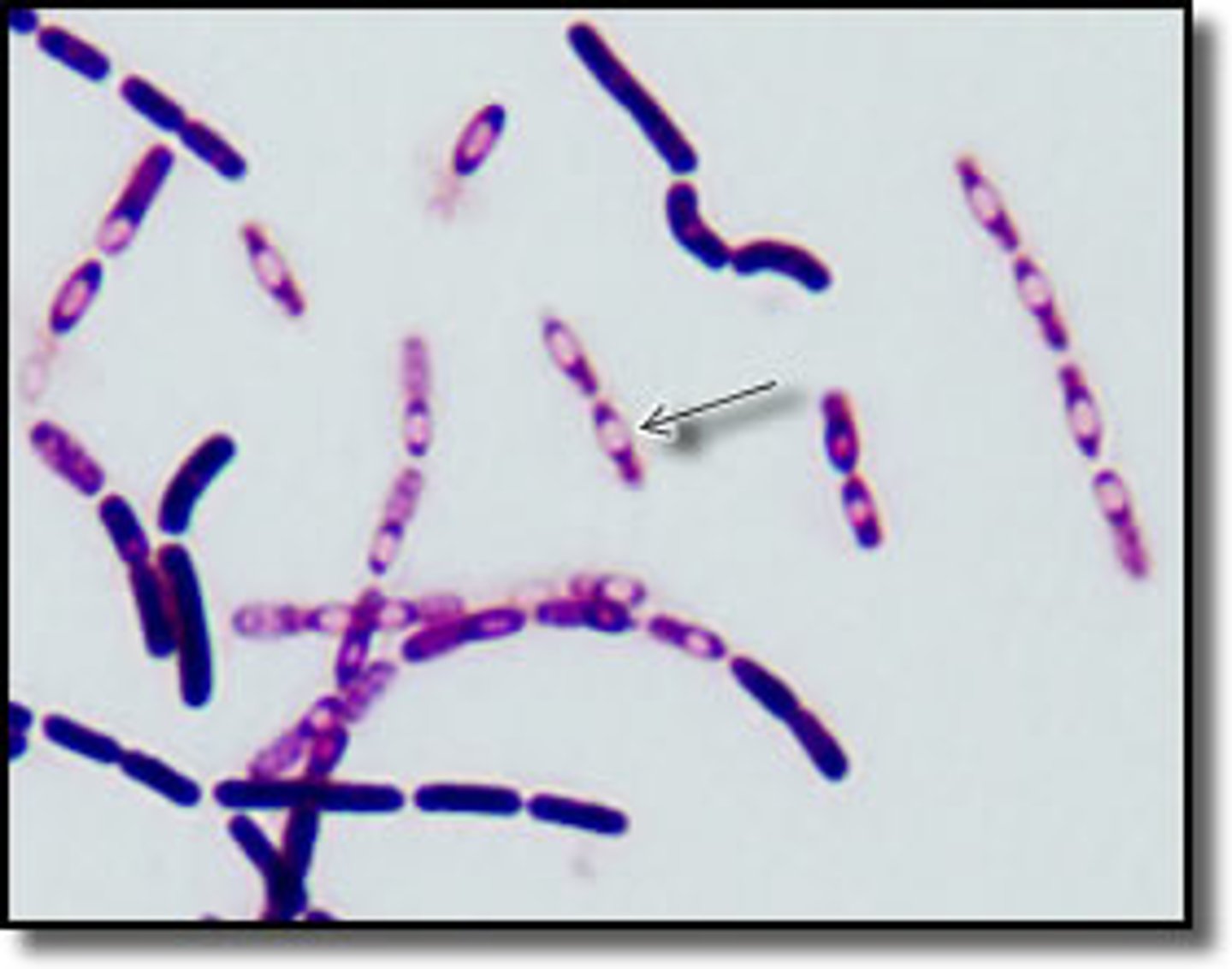 <p>The following image is an example of bacillus bacteria forming endospores.<br>a. True<br>b. False</p>