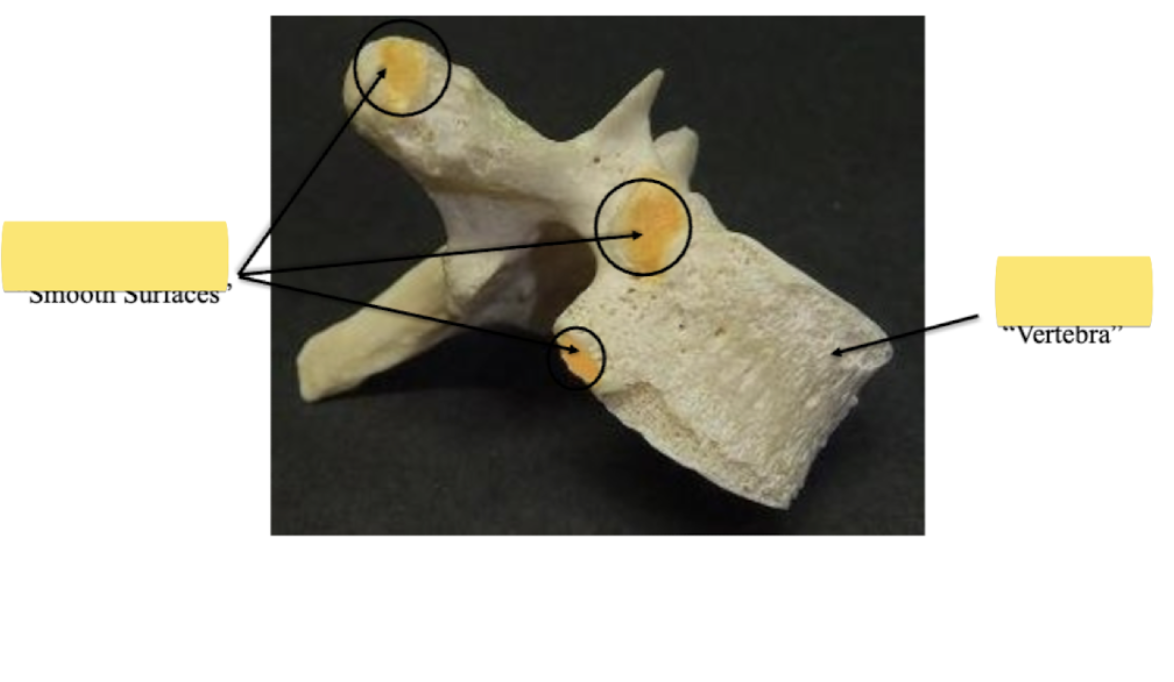 <p>Identify this Vertebra</p>