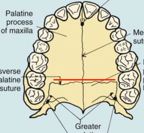 <p>superior flat edge of palatine bone</p>