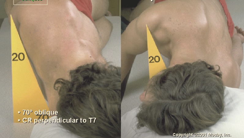 <p>What position is this?</p>