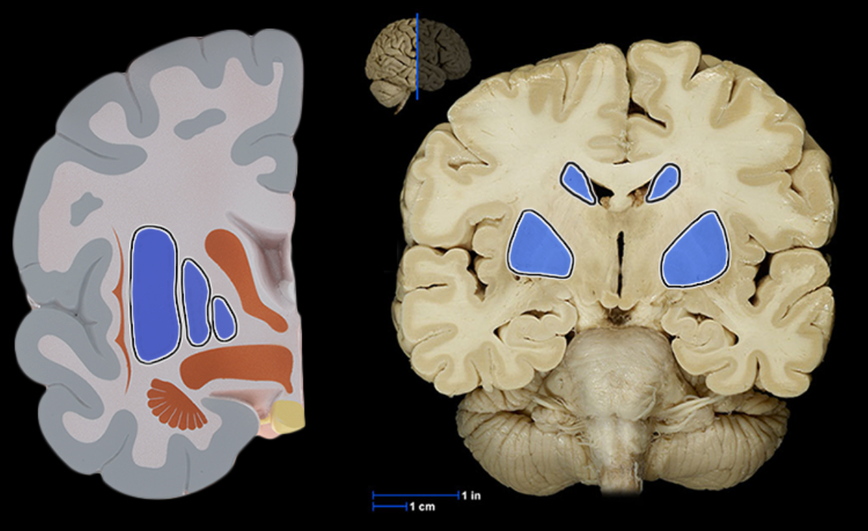 <p>Location:</p><ul><li><p>Cerebrum</p></li></ul><p>Description:</p><ul><li><p>Paired masses of gray matter located deep in each cerebral hemisphere</p></li><li><p>Composed of corpus striatum (caudate nucleus, putamen, and globus pallidus), amygdaloid body, and claustrum</p></li></ul><p>Function:</p><ul><li><p>Planning and execution of movement</p></li><li><p>Controls highly practiced and subconscious movements</p></li><li><p>Muscle tone and posture</p></li></ul><p>Also known as:</p><ul><li><p>Basal ganglia</p></li></ul><p></p>