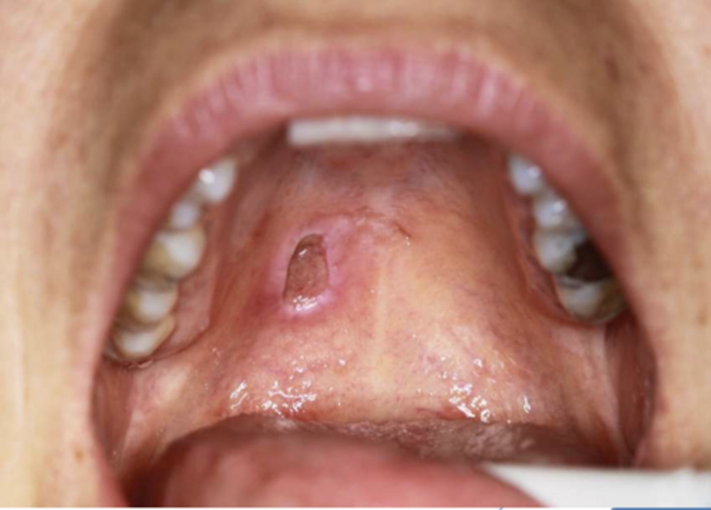 <p>ID the pathology:</p>