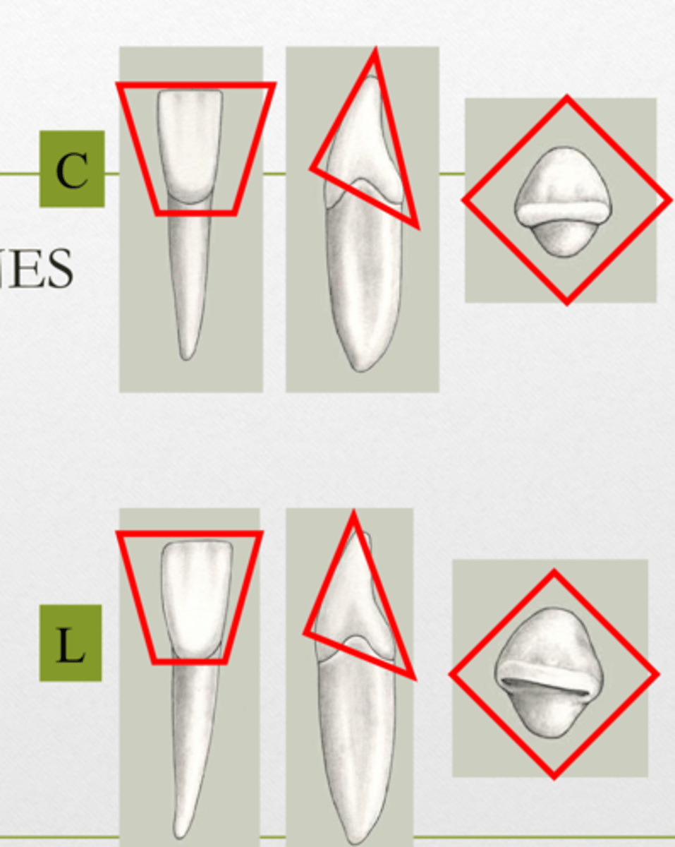 <p>Trapezoidal</p><p>Triangular</p><p>Diamond</p>