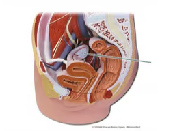 <p><span>Identify the highlighted structure</span></p>