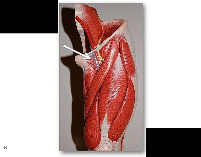 <p>What muscle is this?****</p>