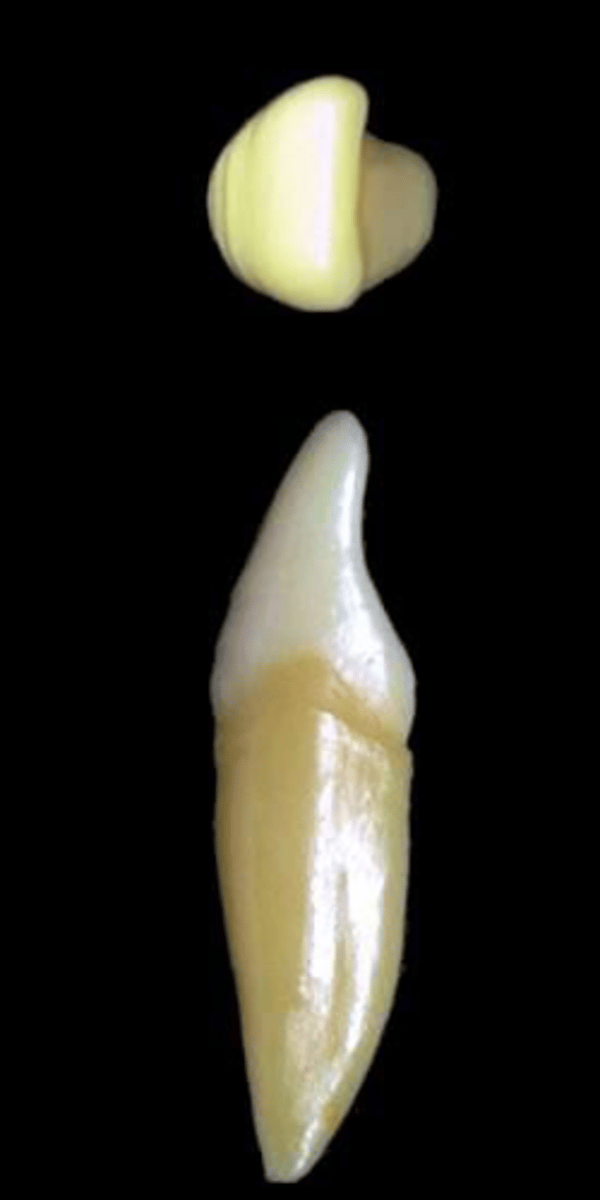 <p>what tooth is this &amp; why?</p>