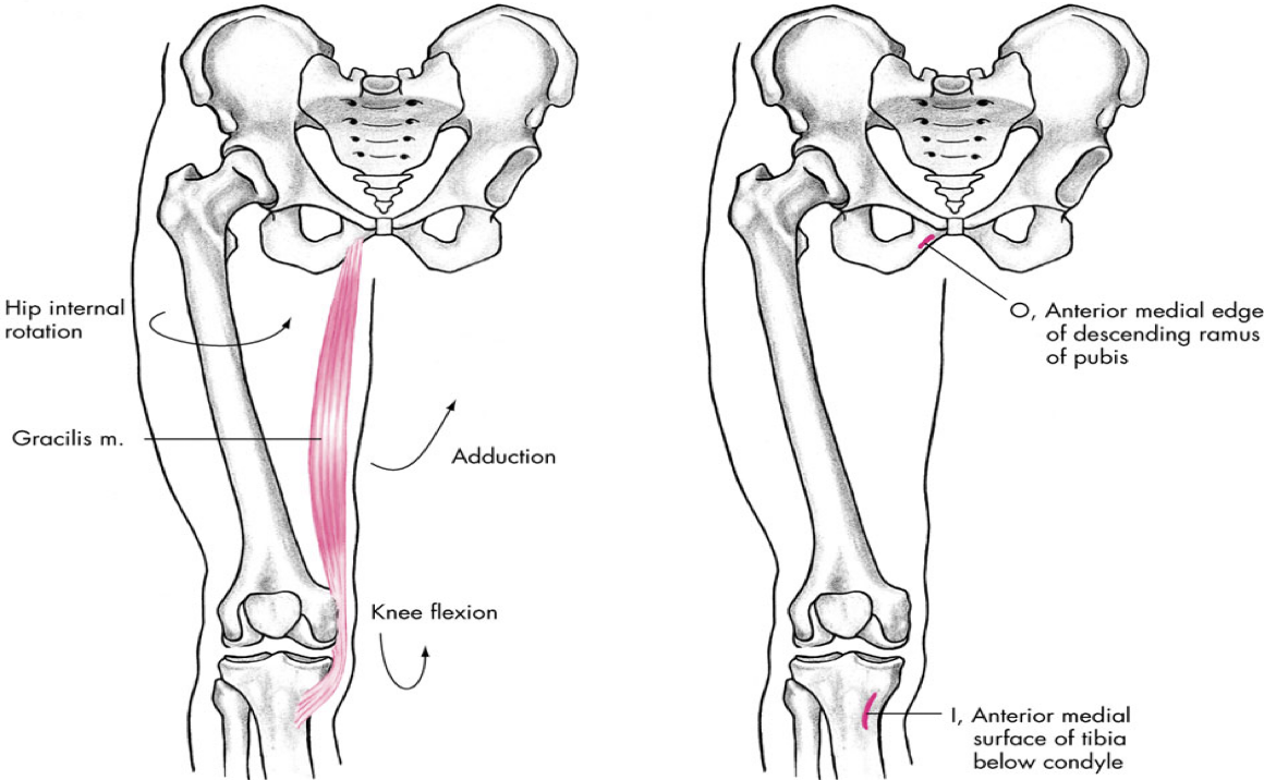<p>medial compartment</p>