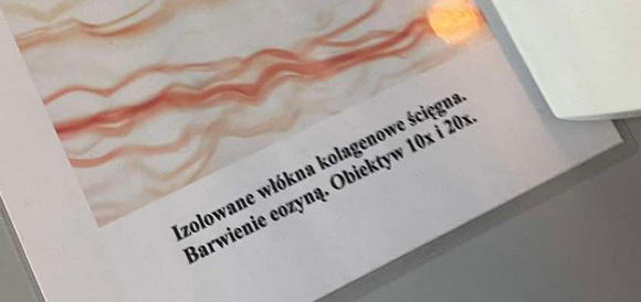 <p>są odborne na rozerwanie i wytrzymałe co umożliwia zapewnienie odporności tkankom</p>