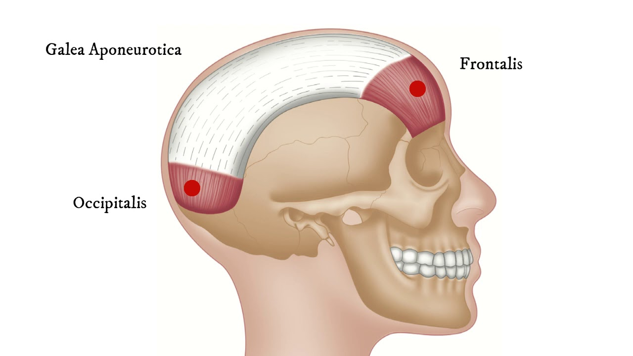 <p>O: occipital bone</p><p>I: epicranial aponeurosis</p><p>A: retract scalp</p>