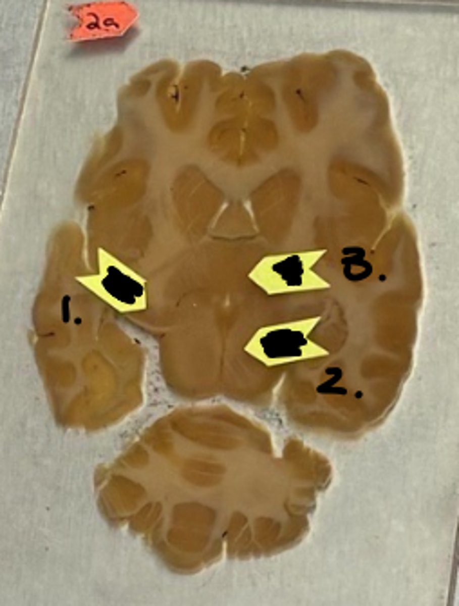 <p>what structure is labeled as #2 ?</p>