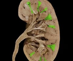 <p>renal columns </p>